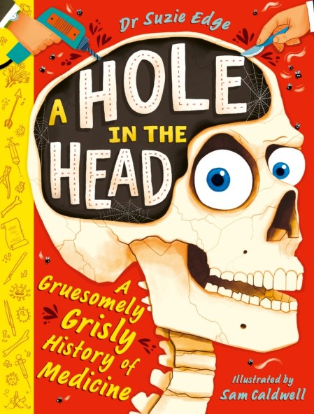 A Hole in the Head